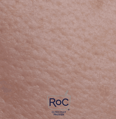 RoC – Barrier Renew Efficacy Video