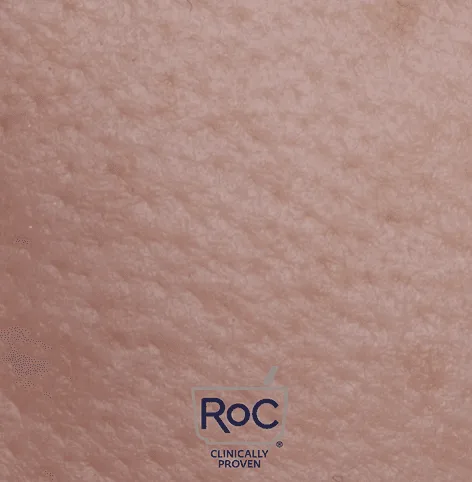 RoC – Barrier Renew Efficacy Video